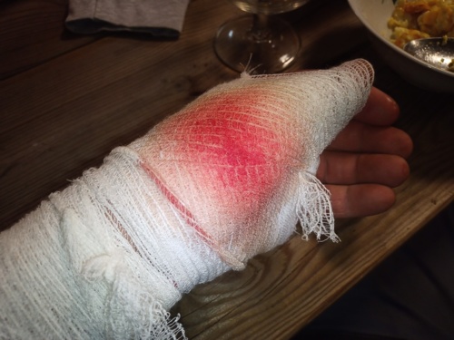 Jedyne co mi na myśl przychodzi to #nsfw i #18+ Nie ma tagów, które by do tego pasowały. Na zdjeciach moja lewa - winiucho - Hejto.pl