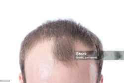 617b1a4e-119d-435f-a57b-dd076da5b339