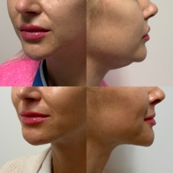 ccd4fc20-5691-41c0-b3fc-3e0f3230817b