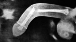 584f4225-b4f1-4e59-84ce-ed01a4e56497